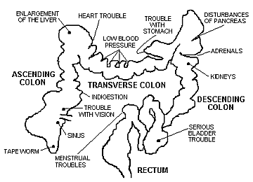 Typical Western Diet Colon, colon cleansing, colonics, lower gastrointestinal tract, colon therapy, detect colon cancer, MA, RI