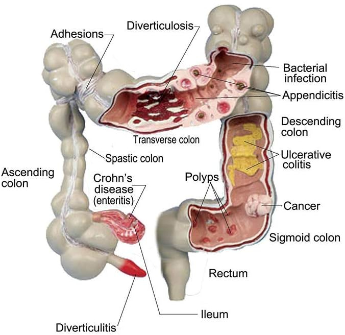 Colon cleansing effects